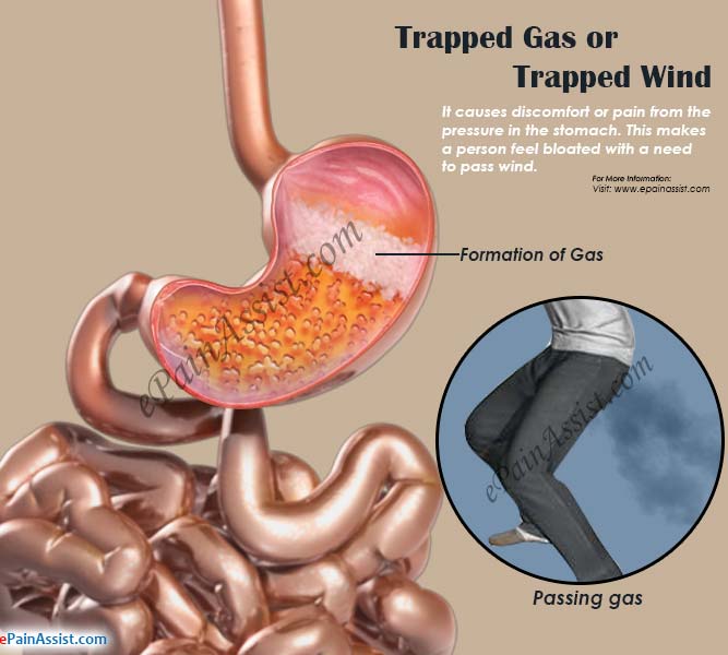 how-to-flush-gas-out-of-the-stomach-with-just-4-ingredients-in-2020